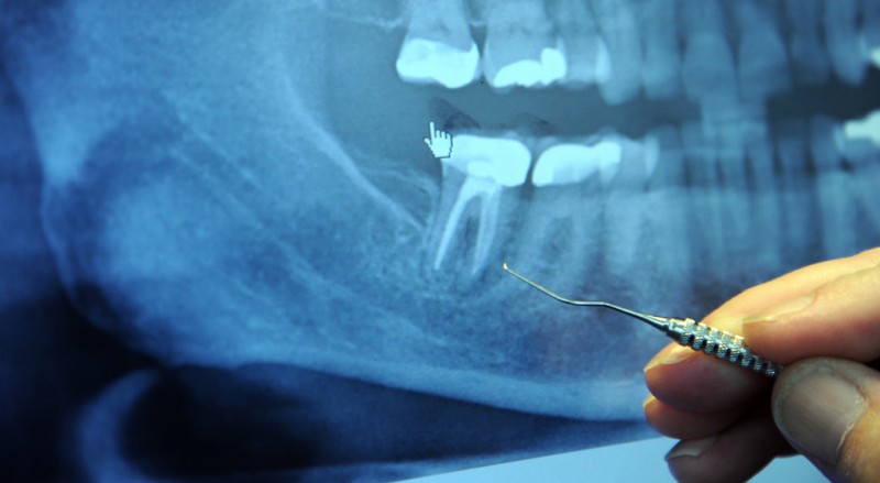 Neues zur QS-RL für Zahnärzte